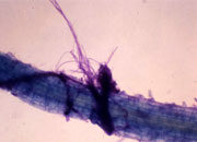 根に絡みついたチビホコリタケ菌糸